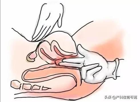 养生卵巢专业知识,常做卵巢保养可以杜绝卵巢早衰(做卵巢保养的十大好处)