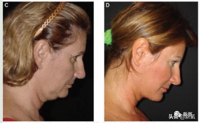 关晓彤和张嘉倪侧颜对决，被摁在地上摩擦啊…(欧阳娜娜侧颜)