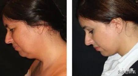 关晓彤和张嘉倪侧颜对决，被摁在地上摩擦啊…(欧阳娜娜侧颜)