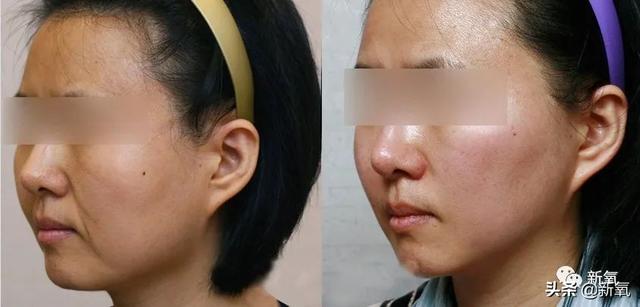 关晓彤和张嘉倪侧颜对决，被摁在地上摩擦啊…(欧阳娜娜侧颜)