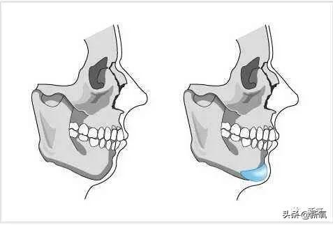 关晓彤和张嘉倪侧颜对决，被摁在地上摩擦啊…(欧阳娜娜侧颜)