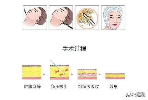 关晓彤和张嘉倪侧颜对决，被摁在地上摩擦啊…(欧阳娜娜侧颜)