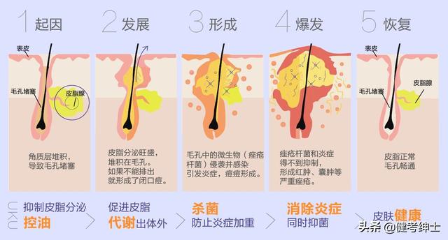 我是一個大一的學生臉上有痘痘皮膚乾燥還黑怎麼辦