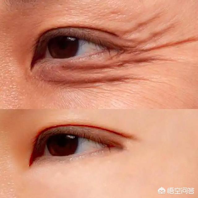 上最重要的一环,因为当眼部开始出现眼袋,松弛,皱纹等老化问题的时候