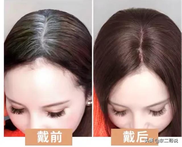 45岁了,头发白了很多经常染都盖不住,有什么好办法吗