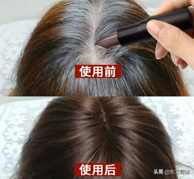 45岁了,头发白了很多经常染都盖不住,有什么好办法吗